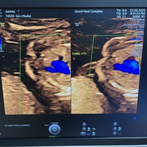 Dr saif sonography (17)
