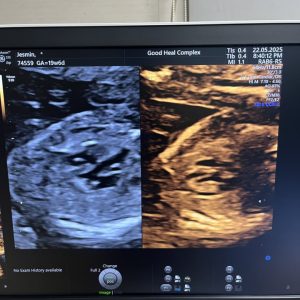 Dr saif sonography (18)