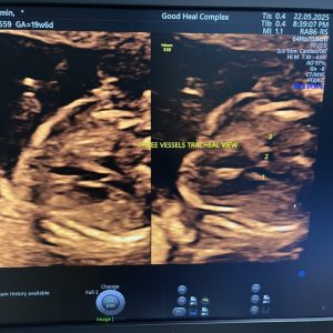 Dr saif sonography (20)