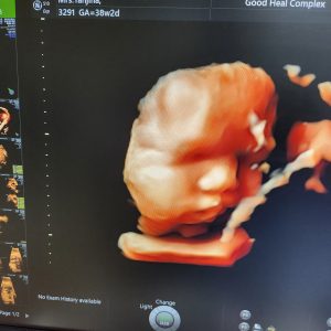 Dr saif sonography (7)